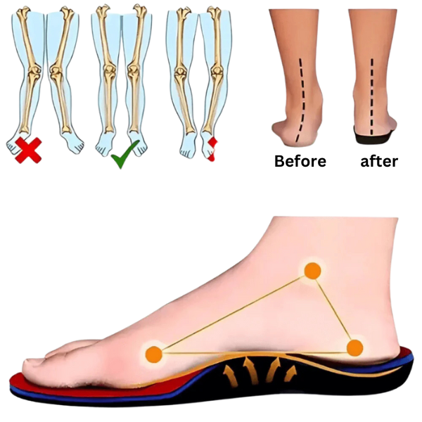 ComfortStep™ - Women's Orthopaedic Shoes